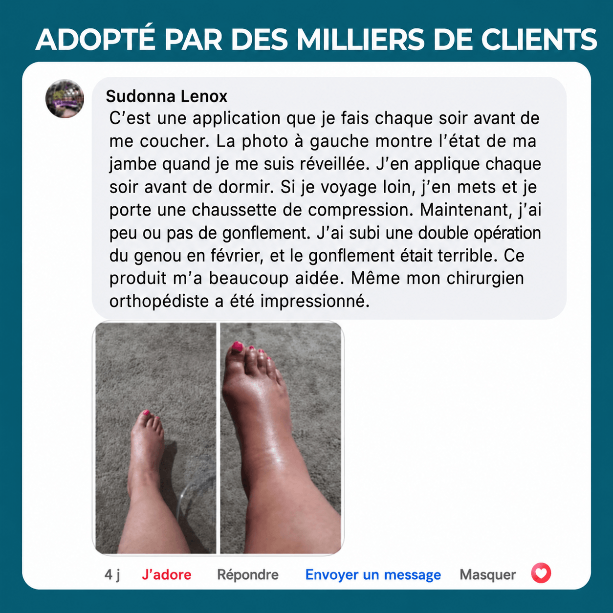 Miracle Balm™ – Baume Puissant aux Plantes