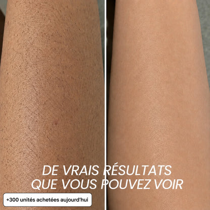 Rasez-vous 3× moins souvent — sans laser, sans rendez-vous.