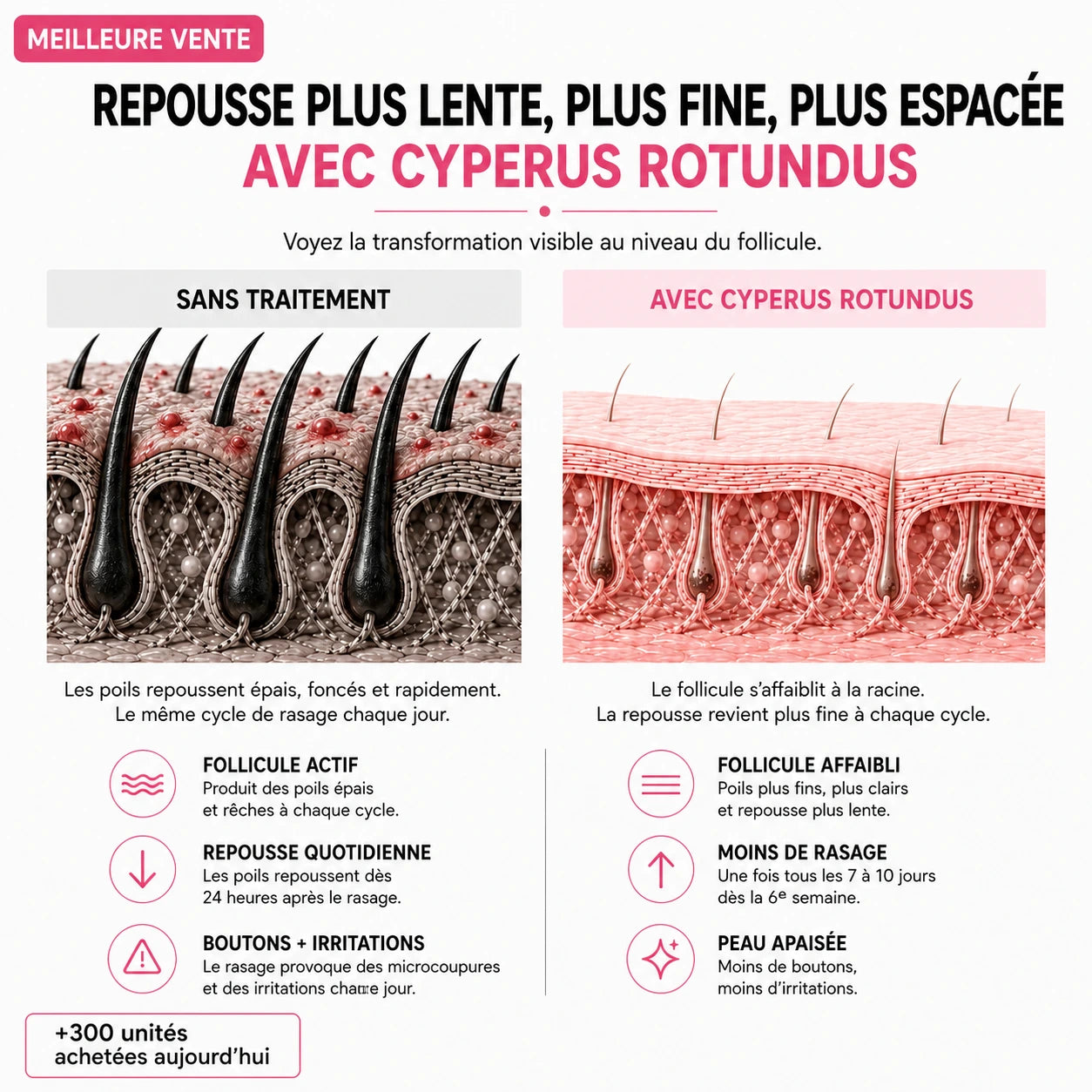 Rasez-vous 3× moins souvent — sans laser, sans rendez-vous.