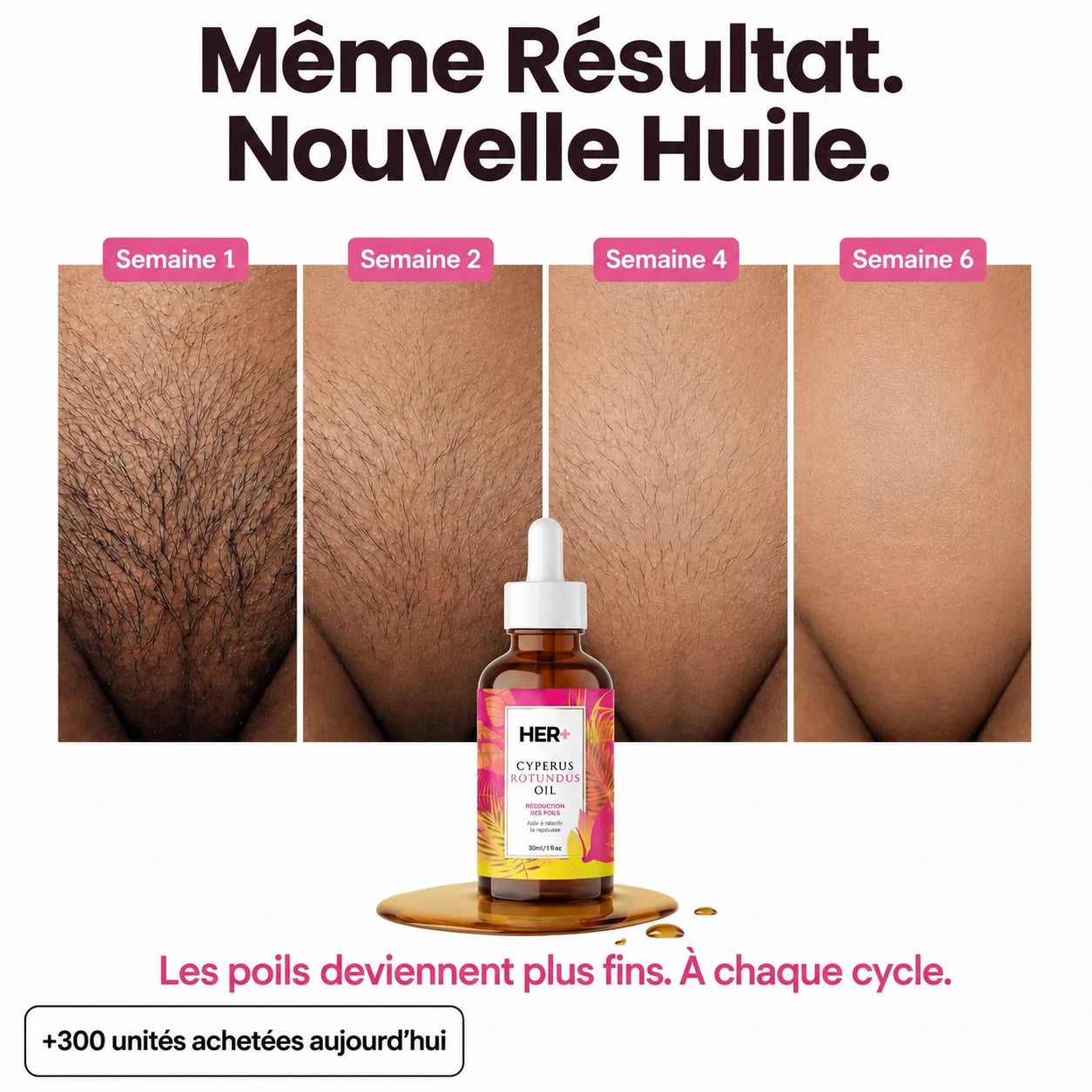 Rasez-vous 3× moins souvent — sans laser, sans rendez-vous.