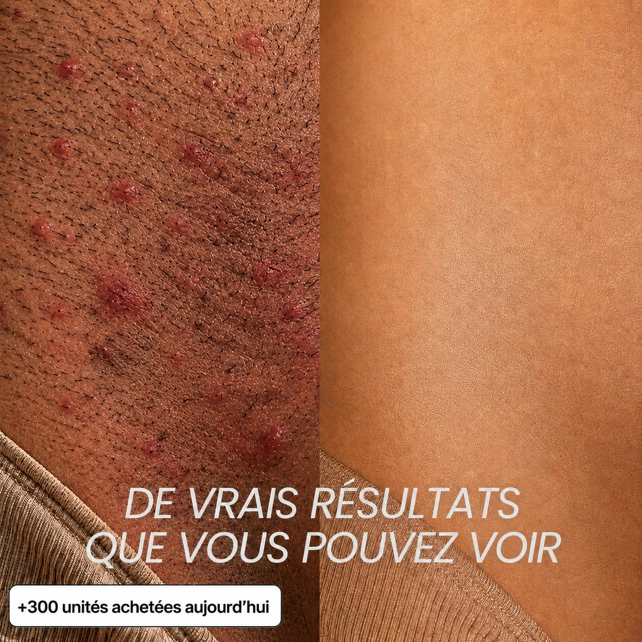 Rasez-vous 3× moins souvent — sans laser, sans rendez-vous.