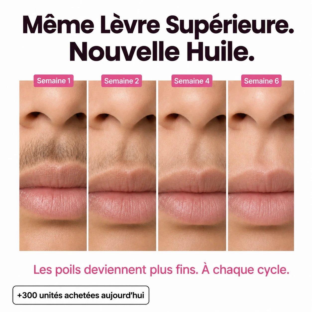 Rasez-vous 3× moins souvent — sans laser, sans rendez-vous.
