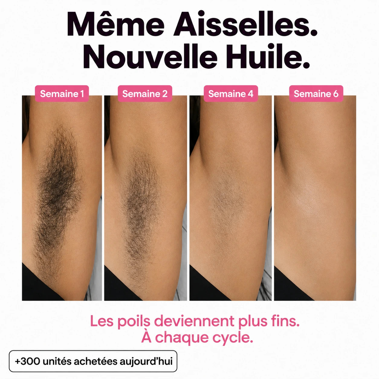 Rasez-vous 3× moins souvent — sans laser, sans rendez-vous.